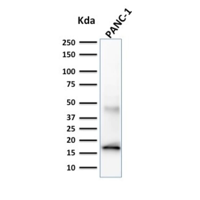 Western Blot - Anti-CELA3B Antibody [CELA3B/1257] - BSA and Azide free (A251779) - Antibodies.com