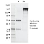 SDS-PAGE - Anti-CELA3B Antibody [CELA3B/1257] - BSA and Azide free (A251779) - Antibodies.com