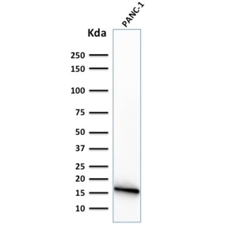 Western Blot - Anti-CELA3B Antibody [CELA3B/1374] - BSA and Azide free (A251780) - Antibodies.com