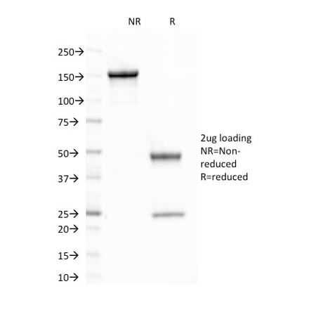 SDS-PAGE - Anti-CELA3B Antibody [CELA3B/1758] - BSA and Azide free (A251781) - Antibodies.com