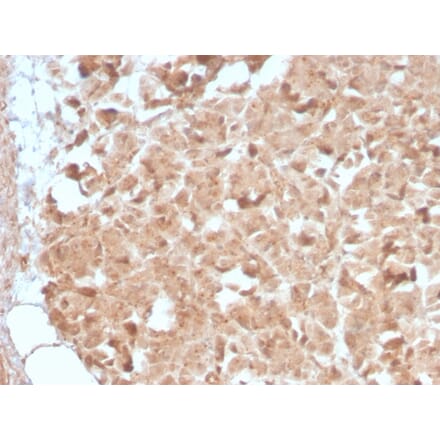 Immunohistochemistry - Anti-CELA3B Antibody [CELA3B/2809R] - BSA and Azide free (A251782) - Antibodies.com