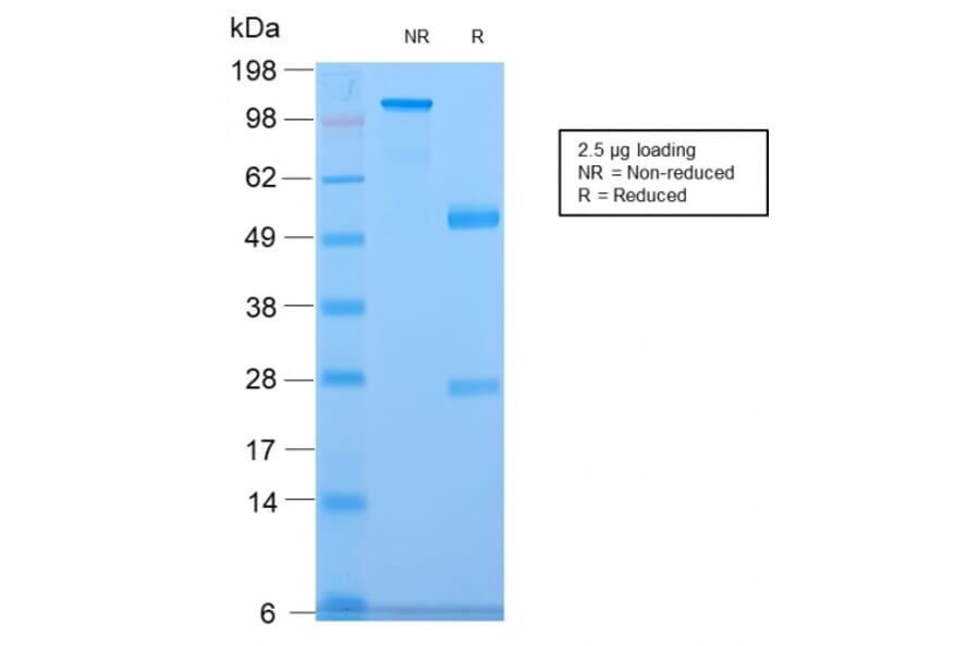 SDS-PAGE - Anti-CELA3B Antibody [CELA3B/2809R] - BSA and Azide free (A251783) - Antibodies.com