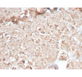 Immunohistochemistry - Anti-CELA3B Antibody [CELA3B/2810R] - BSA and Azide free (A251783) - Antibodies.com