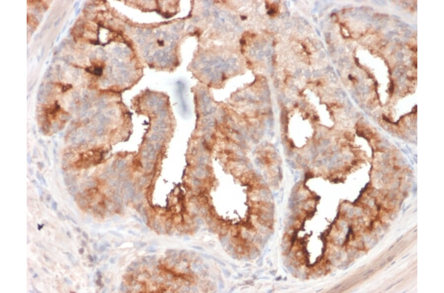 Immunohistochemistry - Anti-PSMA Antibody [FOLH1/2354] - BSA and Azide free (A251786) - Antibodies.com