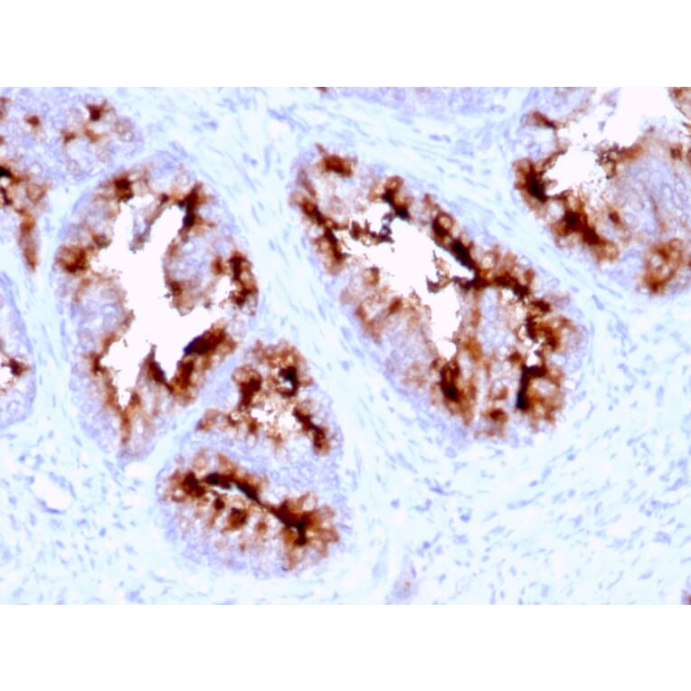 Immunohistochemistry - Anti-PSMA Antibody [FOLH1/2363] - BSA and Azide free (A251787) - Antibodies.com