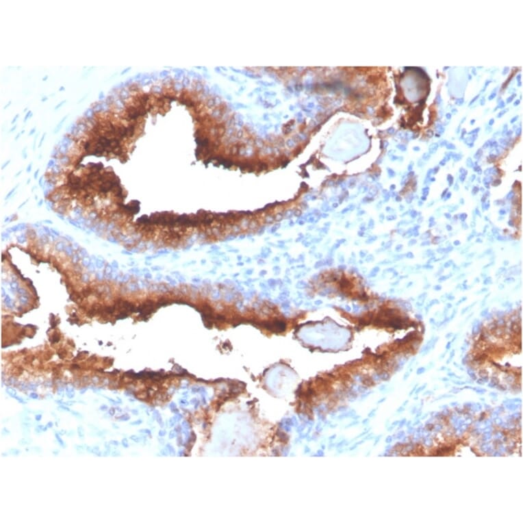 Immunohistochemistry - Anti-PSMA Antibody [FOLH1/3734] - BSA and Azide free (A251790) - Antibodies.com