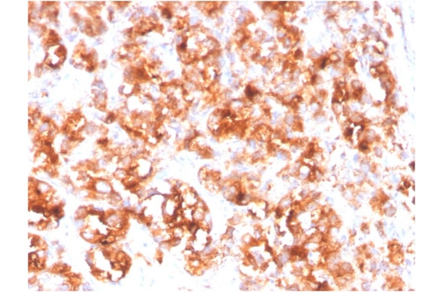 Immunohistochemistry - Anti-PSMA Antibody [FOLH1/3734] - BSA and Azide free (A251790) - Antibodies.com