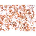 Immunohistochemistry - Anti-PSMA Antibody [FOLH1/3734] - BSA and Azide free (A251790) - Antibodies.com