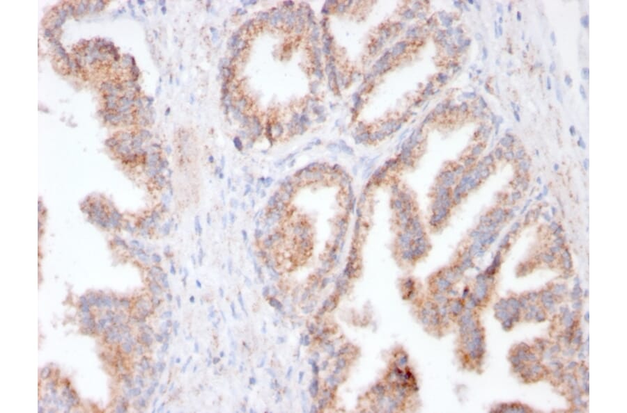 Immunohistochemistry - Anti-PSMA Antibody [FOLH1/3149R] - BSA and Azide free (A251790) - Antibodies.com