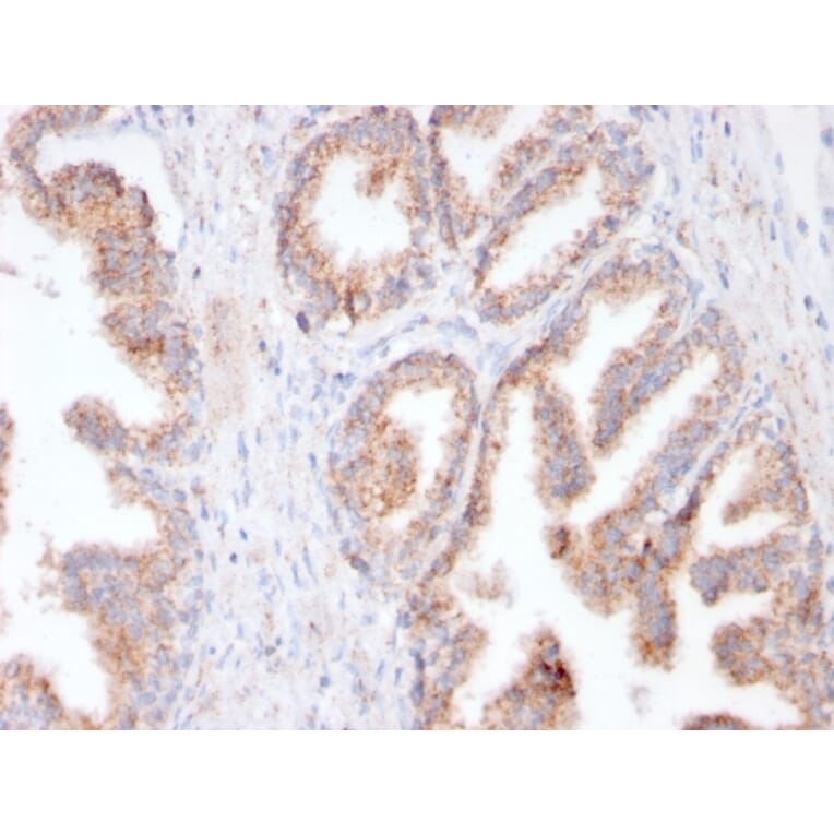 Immunohistochemistry - Anti-PSMA Antibody [FOLH1/3149R] - BSA and Azide free (A251790) - Antibodies.com