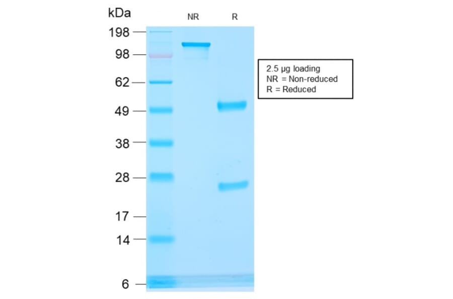 SDS-PAGE - Anti-AMACR Antibody [rAMACR/1864] - BSA and Azide free (A251793) - Antibodies.com