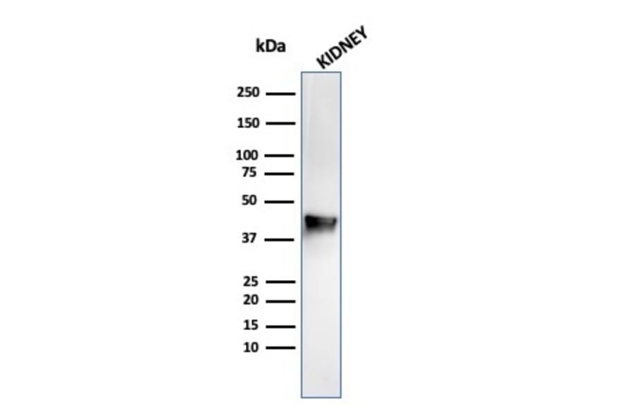 Western Blot - Anti-AMACR Antibody [rAMACR/1864] - BSA and Azide free (A251793) - Antibodies.com