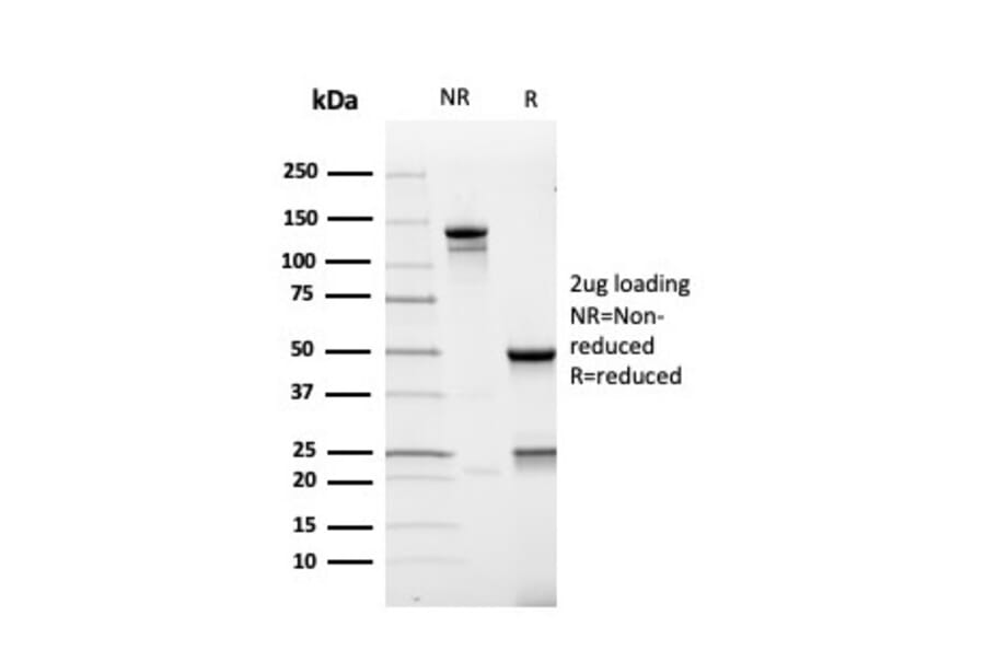 SDS-PAGE - Anti-AMACR Antibody [rAMACR/4674] - BSA and Azide free (A251794) - Antibodies.com