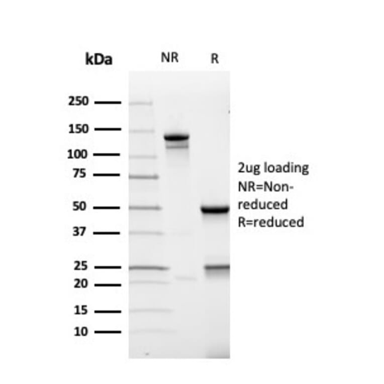 SDS-PAGE - Anti-AMACR Antibody [rAMACR/4674] - BSA and Azide free (A251794) - Antibodies.com