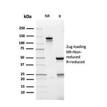 SDS-PAGE - Anti-AMACR Antibody [rAMACR/4674] - BSA and Azide free (A251794) - Antibodies.com