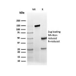 SDS-PAGE - Anti-AMACR Antibody [rAMACR/6369] - BSA and Azide free (A251795) - Antibodies.com