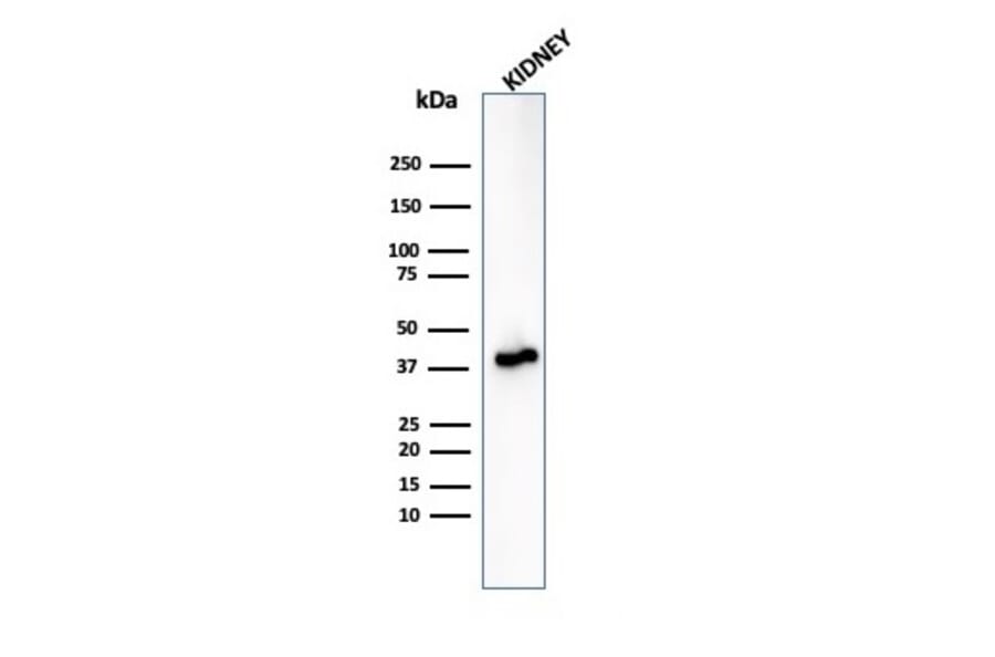 Western Blot - Anti-AMACR Antibody [rAMACR/6369] - BSA and Azide free (A251795) - Antibodies.com