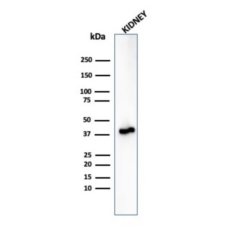 Western Blot - Anti-AMACR Antibody [rAMACR/6369] - BSA and Azide free (A251795) - Antibodies.com