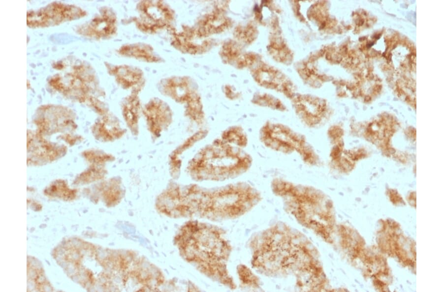 Immunohistochemistry - Anti-AMACR Antibody [AMACR/1723] - BSA and Azide free (A251795) - Antibodies.com