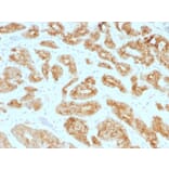 Immunohistochemistry - Anti-AMACR Antibody [AMACR/1723] - BSA and Azide free (A251795) - Antibodies.com