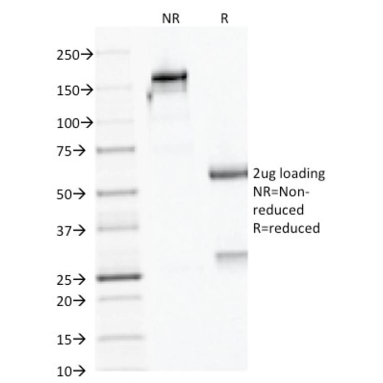 SDS-PAGE - Anti-AMACR Antibody [AMACR/1723] - BSA and Azide free (A251796) - Antibodies.com
