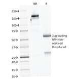 SDS-PAGE - Anti-AMACR Antibody [AMACR/1723] - BSA and Azide free (A251796) - Antibodies.com