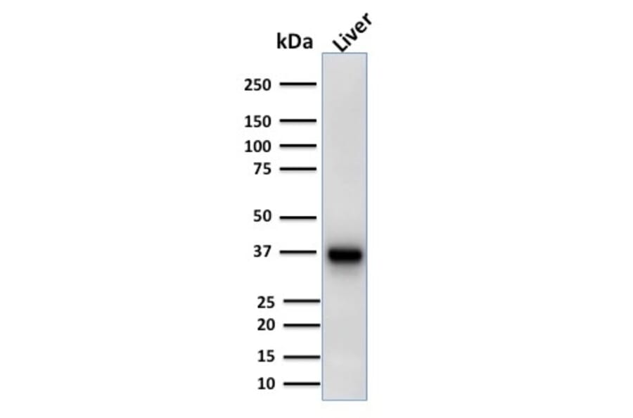 Western Blot - Anti-AMACR Antibody [AMACR/1723] - BSA and Azide free (A251796) - Antibodies.com