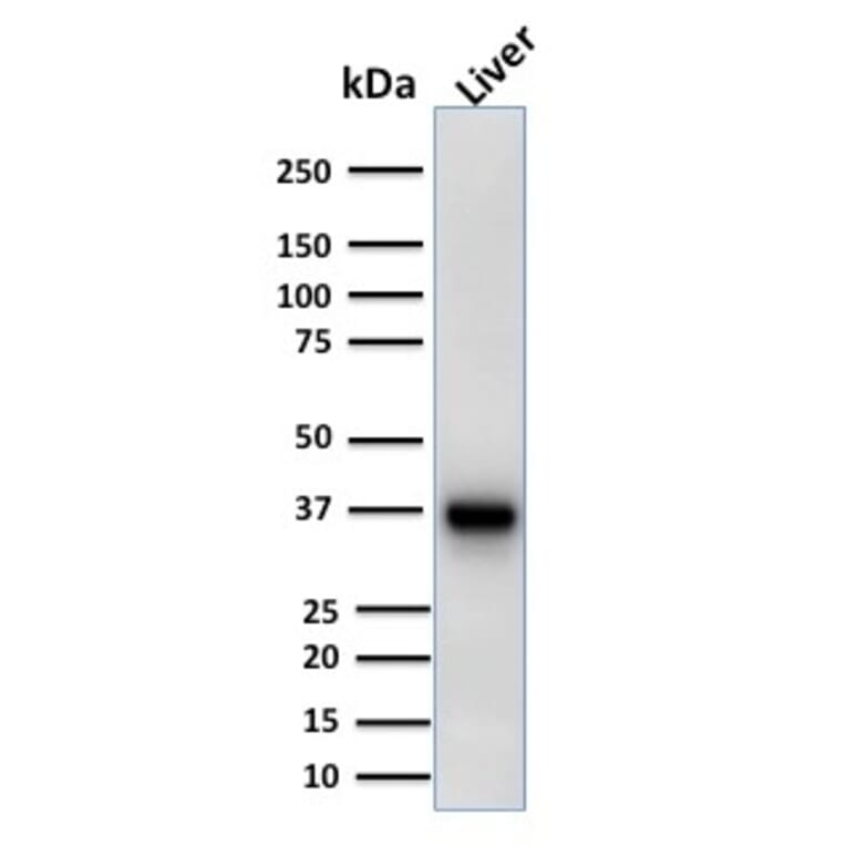 Western Blot - Anti-AMACR Antibody [AMACR/1723] - BSA and Azide free (A251796) - Antibodies.com