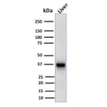 Western Blot - Anti-AMACR Antibody [AMACR/1723] - BSA and Azide free (A251796) - Antibodies.com