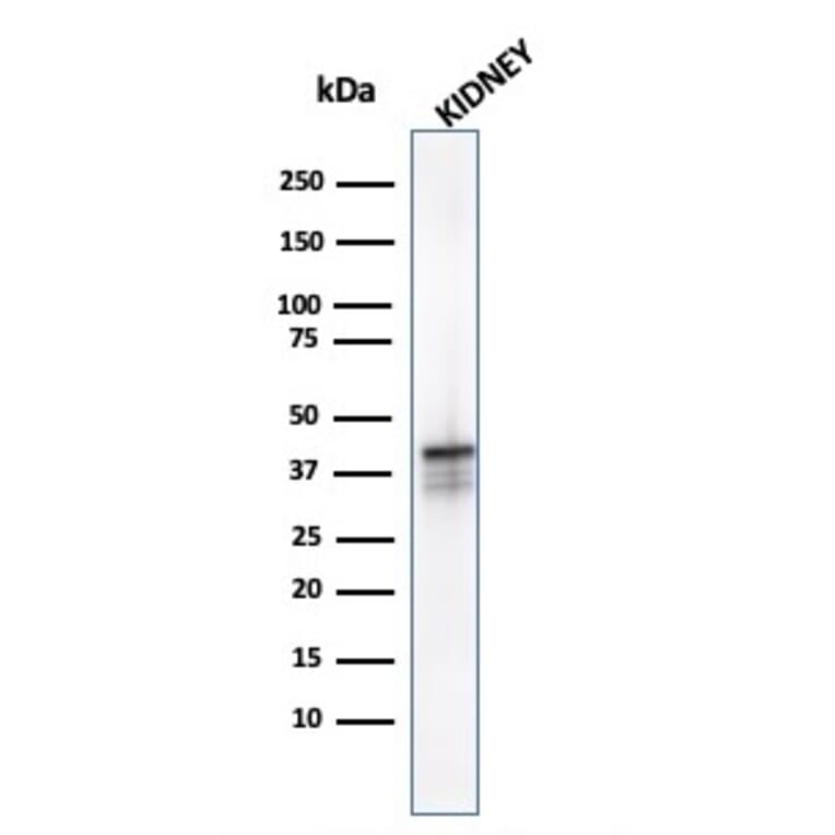 Western Blot - Anti-AMACR Antibody [AMACR/1723] - BSA and Azide free (A251796) - Antibodies.com