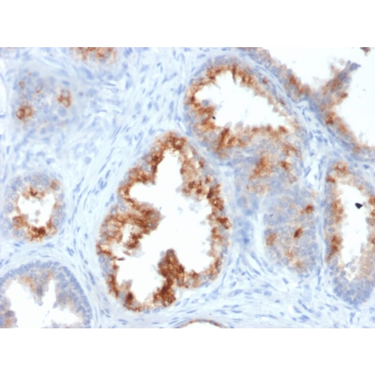 Immunohistochemistry - Anti-AMACR Antibody [AMACR/1864] - BSA and Azide free (A251797) - Antibodies.com
