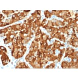 Immunohistochemistry - Anti-AMACR Antibody [AMACR/1864] - BSA and Azide free (A251797) - Antibodies.com