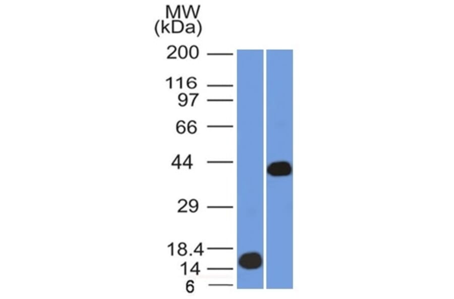 Western Blot - Anti-AMACR Antibody [AMACR/1864] - BSA and Azide free (A251797) - Antibodies.com