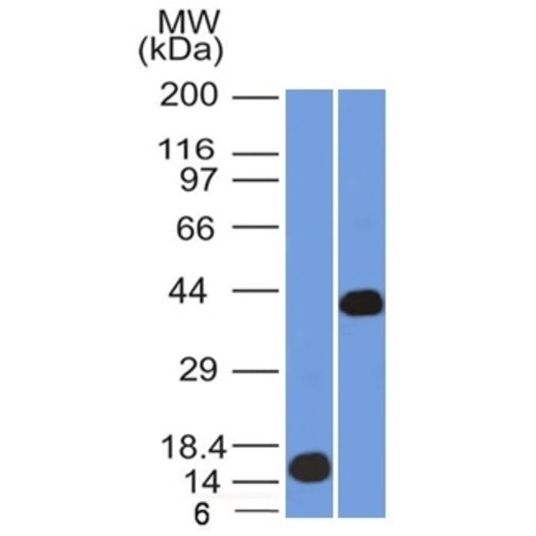 Western Blot - Anti-AMACR Antibody [AMACR/1864] - BSA and Azide free (A251797) - Antibodies.com
