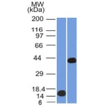 Western Blot - Anti-AMACR Antibody [AMACR/1864] - BSA and Azide free (A251797) - Antibodies.com