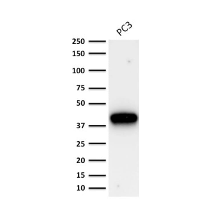Western Blot - Anti-AMACR Antibody [AMACR/1864] - BSA and Azide free (A251797) - Antibodies.com