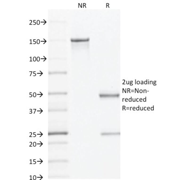 SDS-PAGE - Anti-AMACR Antibody [AMACR/1864] - BSA and Azide free (A251797) - Antibodies.com