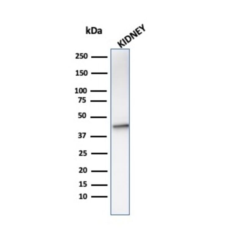 Western Blot - Anti-AMACR Antibody [AMACR/1864] - BSA and Azide free (A251797) - Antibodies.com