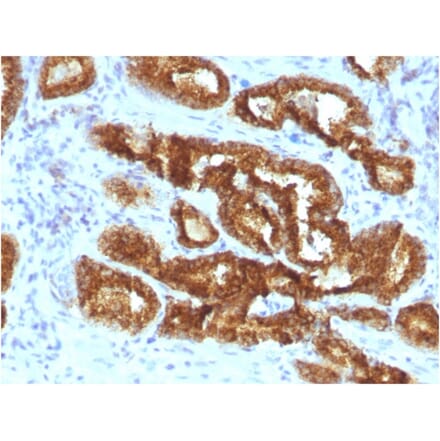 Immunohistochemistry - Anti-AMACR Antibody [AMACR/3931R] - BSA and Azide free (A251797) - Antibodies.com
