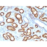 Immunohistochemistry - Anti-AMACR Antibody [AMACR/3931R] - BSA and Azide free (A251798) - Antibodies.com