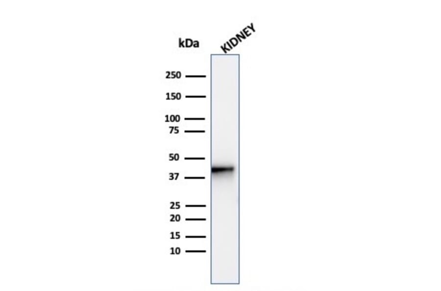 Western Blot - Anti-AMACR Antibody [AMACR/4572R] - BSA and Azide free (A251799) - Antibodies.com