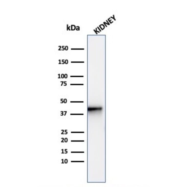 Western Blot - Anti-AMACR Antibody [AMACR/4572R] - BSA and Azide free (A251799) - Antibodies.com