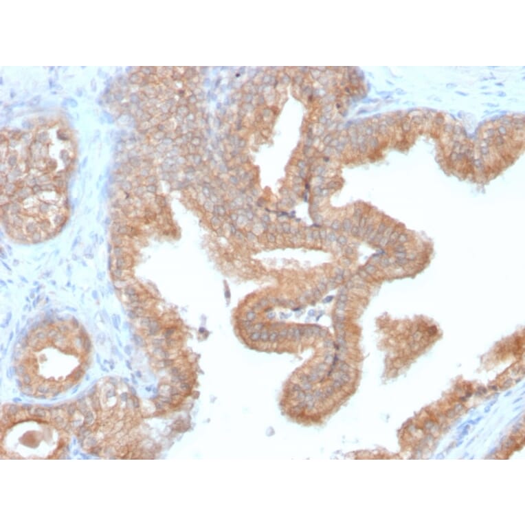 Immunohistochemistry - Anti-AMACR Antibody [AMACR/2748R] - BSA and Azide free (A251799) - Antibodies.com