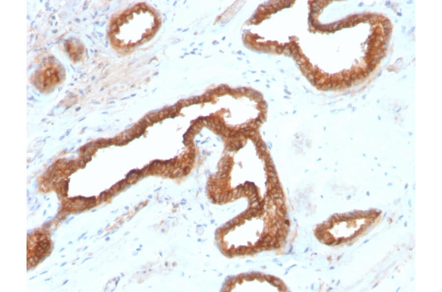Immunohistochemistry - Anti-AMACR Antibody [AMACR/2748R] - BSA and Azide free (A251800) - Antibodies.com