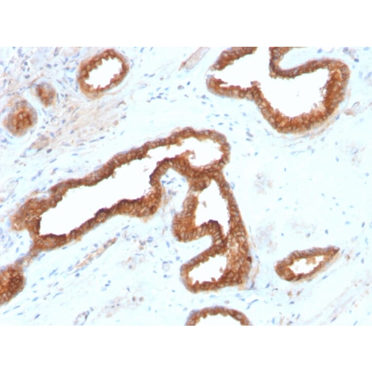 Immunohistochemistry - Anti-AMACR Antibody [AMACR/2748R] - BSA and Azide free (A251800) - Antibodies.com