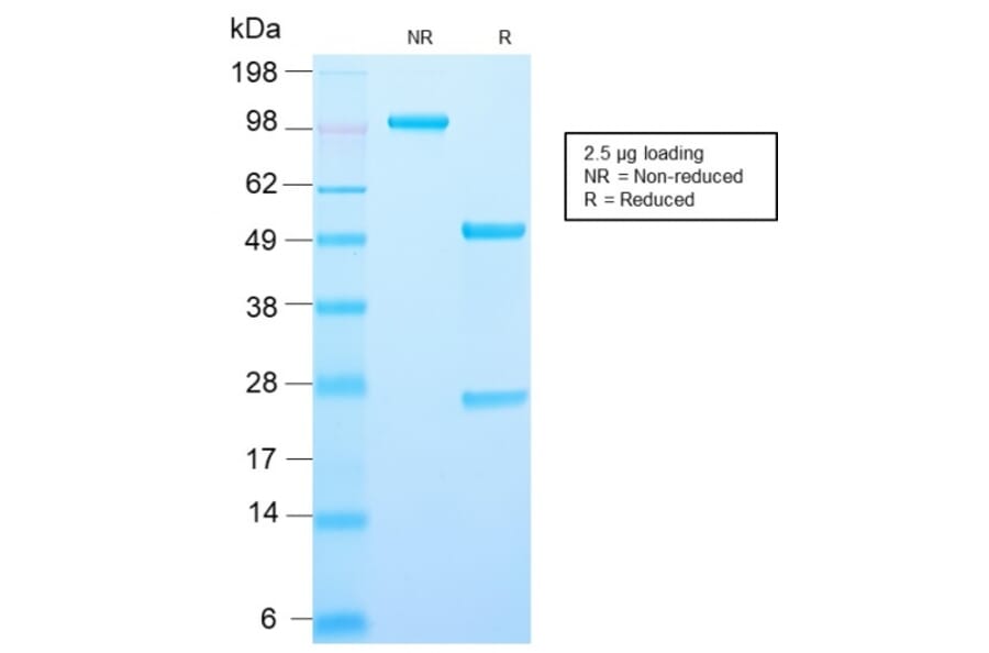 SDS-PAGE - Anti-AMACR Antibody [AMACR/2748R] - BSA and Azide free (A251800) - Antibodies.com