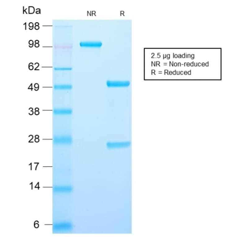 SDS-PAGE - Anti-AMACR Antibody [AMACR/2748R] - BSA and Azide free (A251800) - Antibodies.com