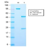 SDS-PAGE - Anti-AMACR Antibody [AMACR/2748R] - BSA and Azide free (A251800) - Antibodies.com