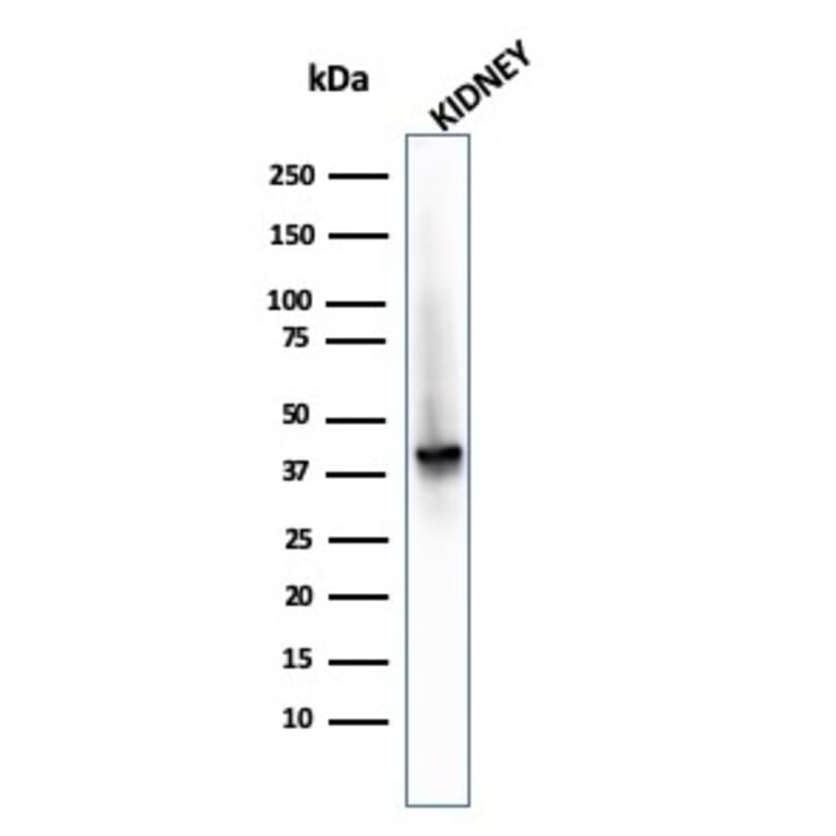 Western Blot - Anti-AMACR Antibody [AMACR/2748R] - BSA and Azide free (A251800) - Antibodies.com