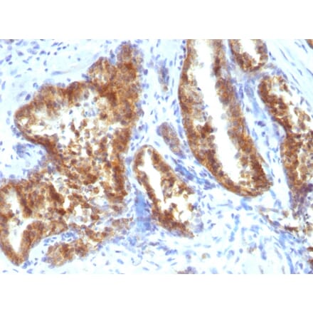 Immunohistochemistry - Anti-AMACR Antibody - BSA and Azide free (A251801) - Antibodies.com